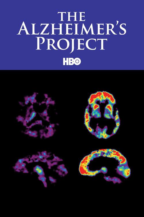 Projeto Alzheimer